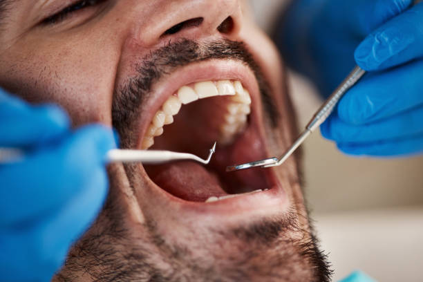 Best Emergency Dentist for Knocked-Out Tooth in Beeville, TX